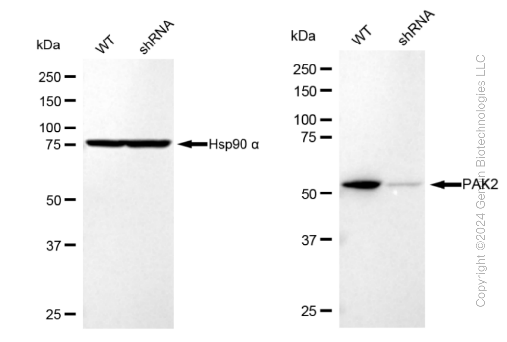 KD-Validated Anti-PAK2 Rabbit Monoclonal Antibody ABG1137