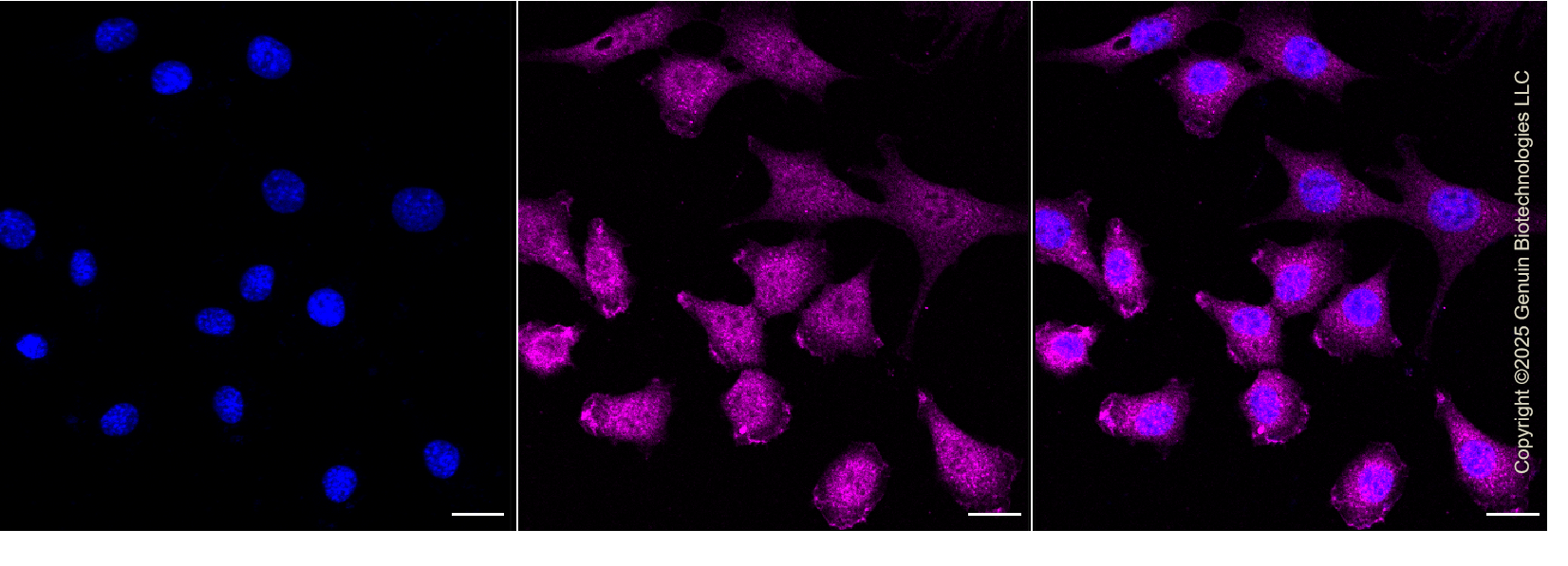 KD-Validated Anti-OGT Rabbit Monoclonal Antibody ABG1140
