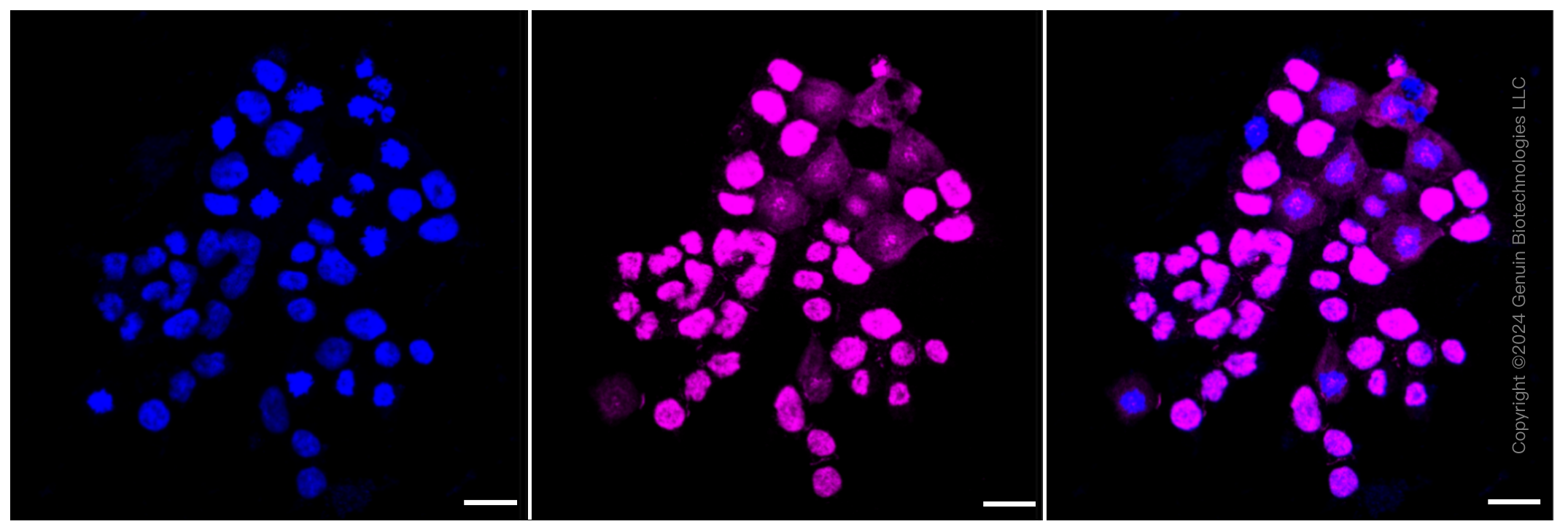 KD-Validated Anti-SMARCE1 Rabbit Monoclonal Antibody ABG1141