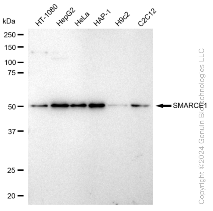 KD-Validated Anti-SMARCE1 Rabbit Monoclonal Antibody ABG1141