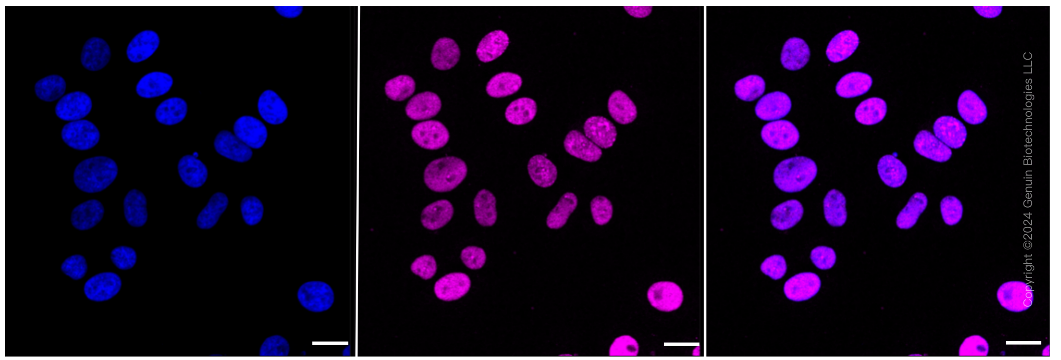 KD-Validated Anti-p150 CAF1 Rabbit Monoclonal Antibody ABG1142