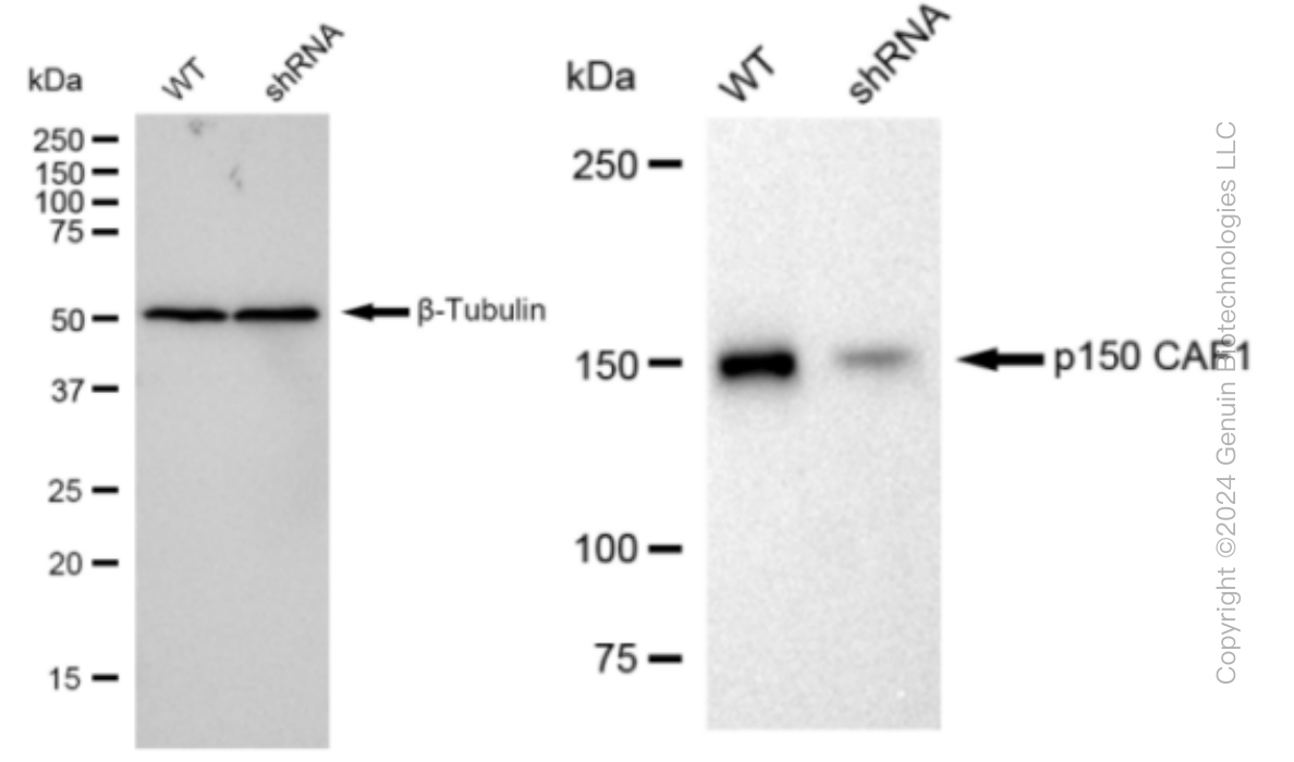 KD-Validated Anti-p150 CAF1 Rabbit Monoclonal Antibody ABG1142