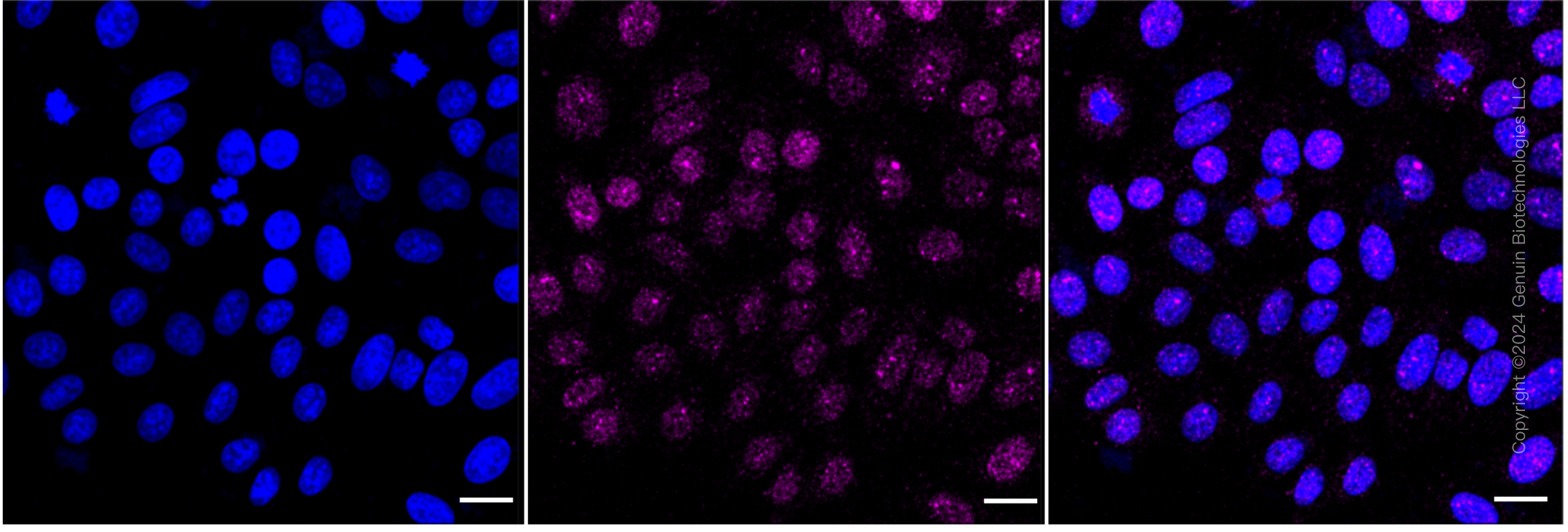 KD-Validated Anti-Catalase Rabbit Monoclonal Antibody ABG1143