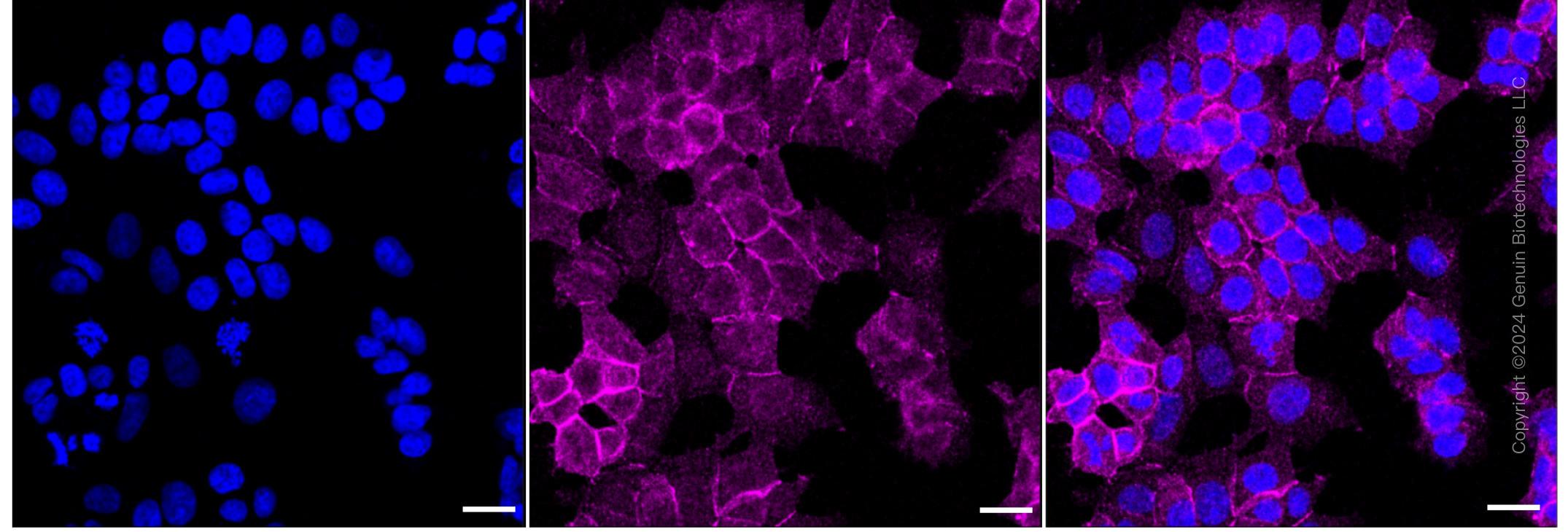 KD-Validated Anti-NF2 / Merlin Rabbit Monoclonal Antibody ABG1144
