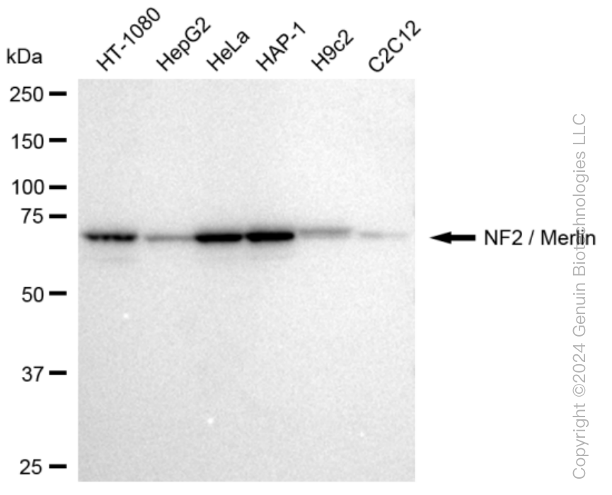 KD-Validated Anti-NF2 / Merlin Rabbit Monoclonal Antibody ABG1144