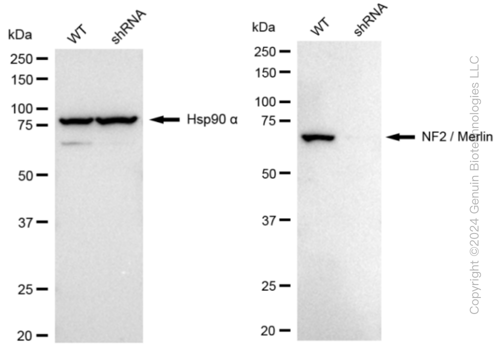 KD-Validated Anti-NF2 / Merlin Rabbit Monoclonal Antibody ABG1144