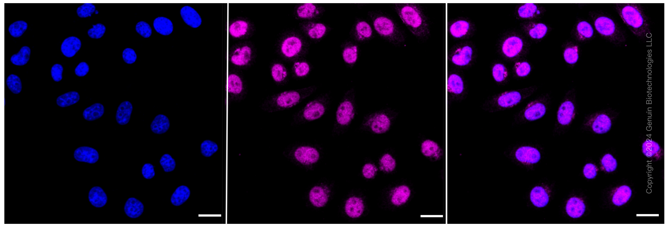 KD-Validated Anti-Chromodomain helicase DNA binding 4 Rabbit Monoclonal Antibody ABG1145