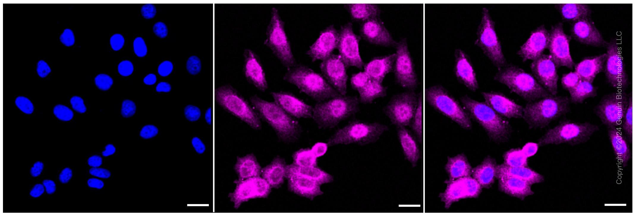 KD-Validated Anti-CHMP2B Rabbit Monoclonal Antibody ABG1146