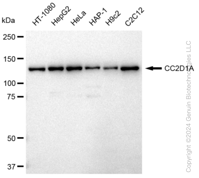 KD-Validated Anti-CC2D1A Rabbit Monoclonal Antibody ABG1147