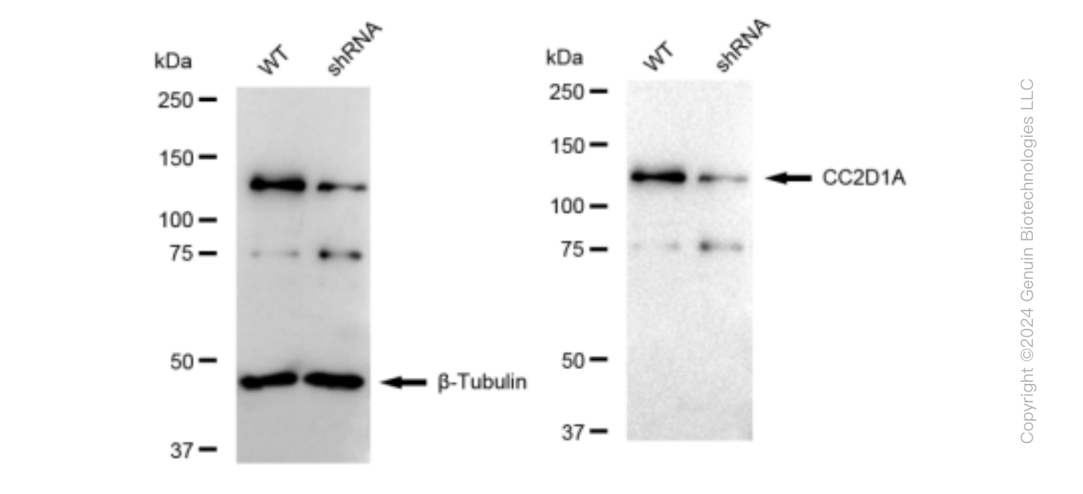 KD-Validated Anti-CC2D1A Rabbit Monoclonal Antibody ABG1147