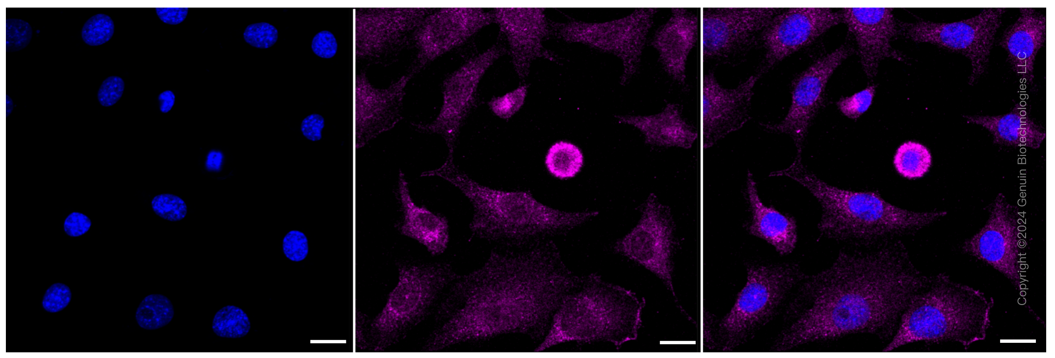 KD-Validated Anti-AP2S1 Rabbit Monoclonal Antibody ABG1149