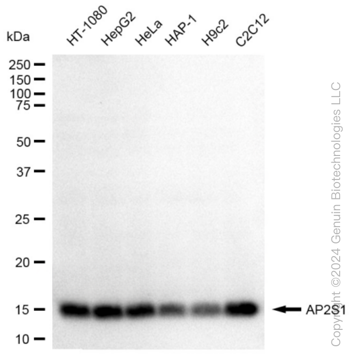 KD-Validated Anti-AP2S1 Rabbit Monoclonal Antibody ABG1149