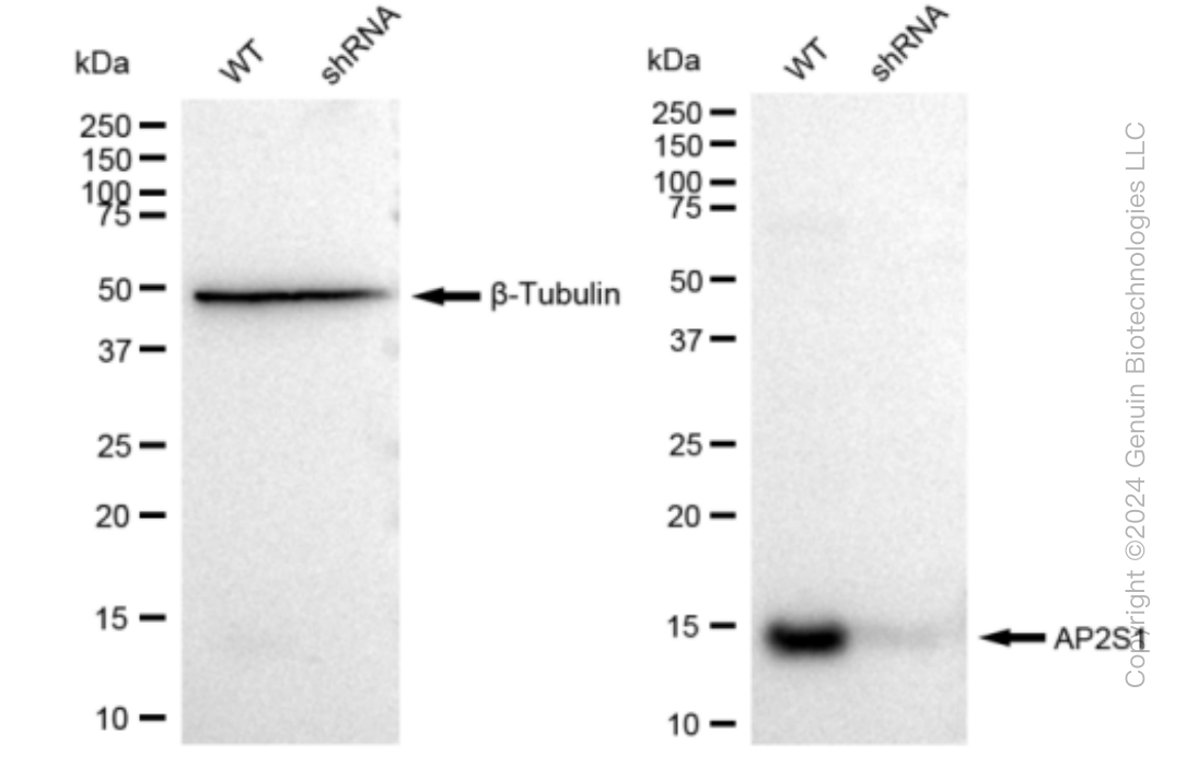 KD-Validated Anti-AP2S1 Rabbit Monoclonal Antibody ABG1149
