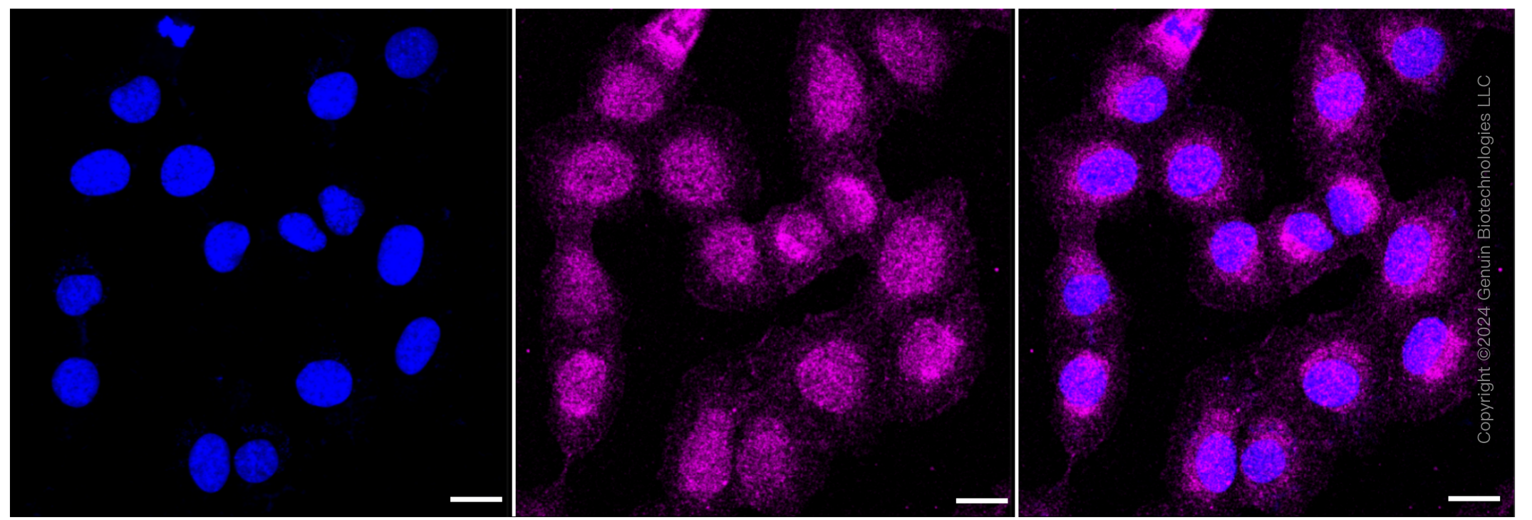 KD-Validated Anti-ACSL4 Rabbit Monoclonal Antibody ABG1150