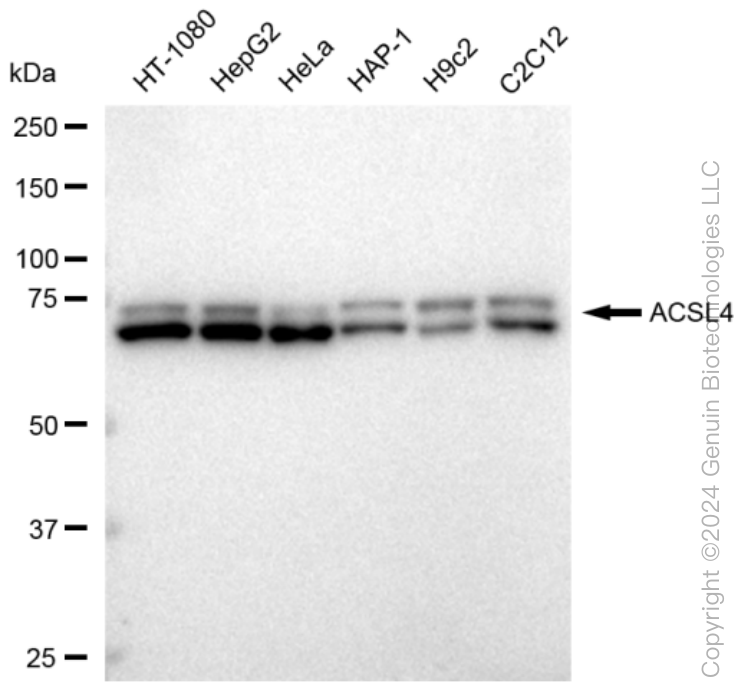 KD-Validated Anti-ACSL4 Rabbit Monoclonal Antibody ABG1150