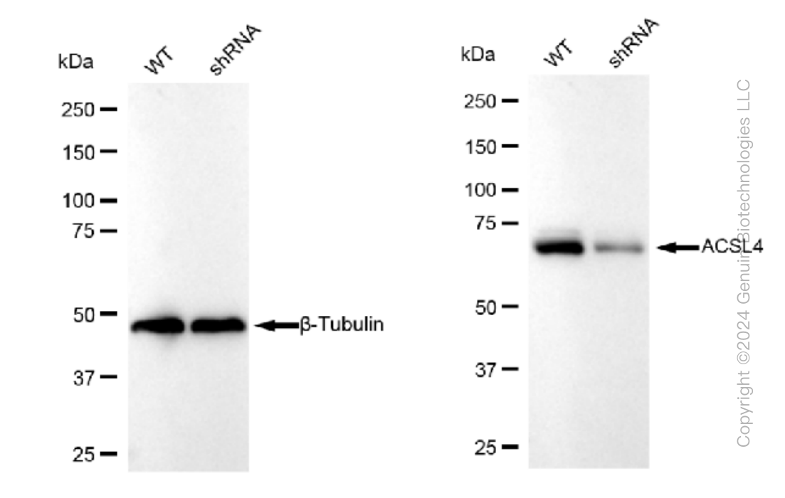 KD-Validated Anti-ACSL4 Rabbit Monoclonal Antibody ABG1150