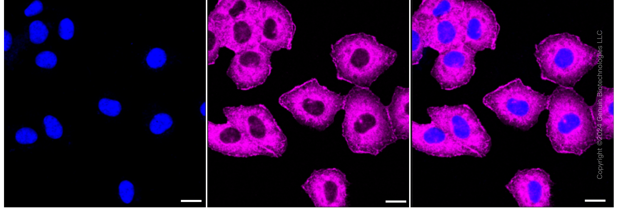 KD-Validated Anti-CAP1 Rabbit Monoclonal Antibody ABG1154