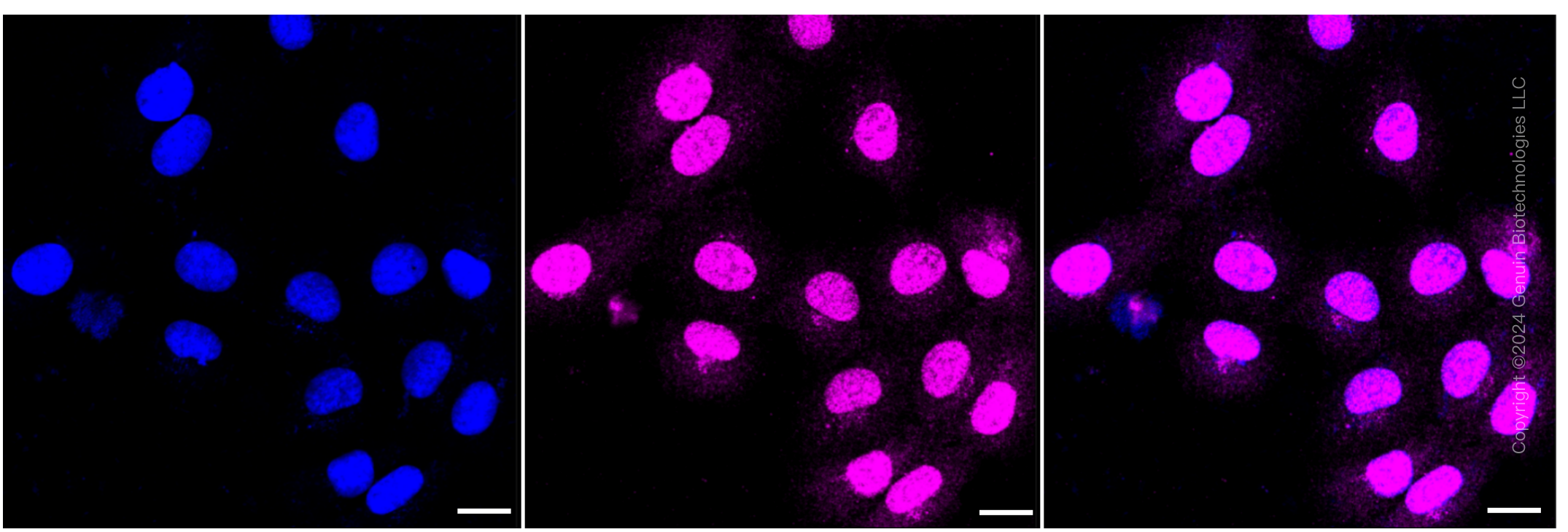 KD-Validated Anti-CLPTM1 Rabbit Monoclonal Antibody ABG1155