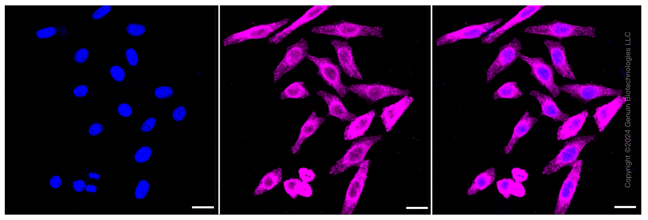 KD-Validated Anti-CLIP1 Rabbit Monoclonal Antibody ABG1157