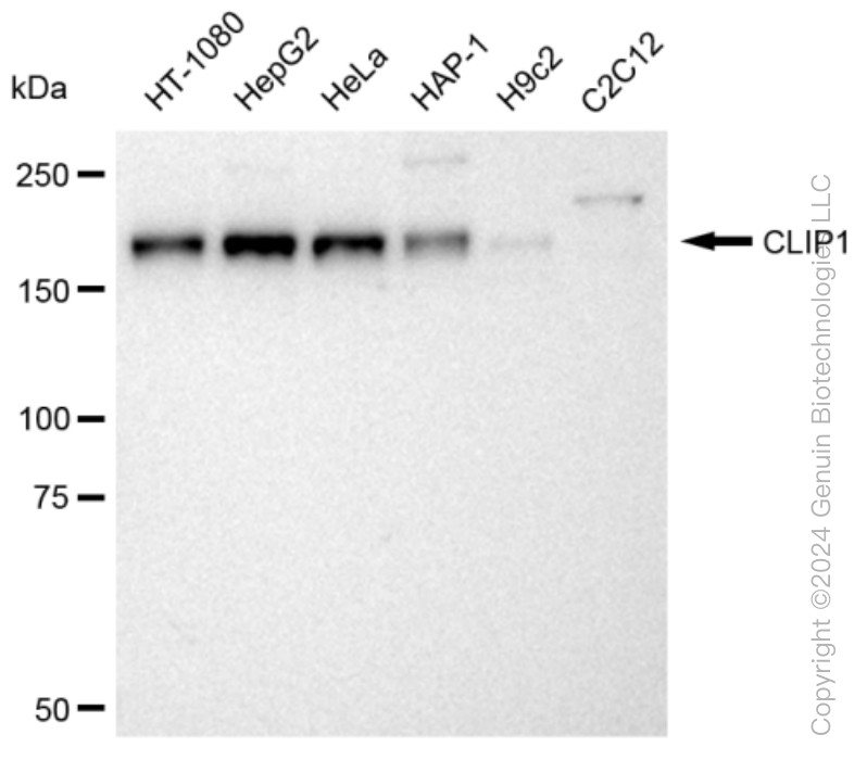 KD-Validated Anti-CLIP1 Rabbit Monoclonal Antibody ABG1157