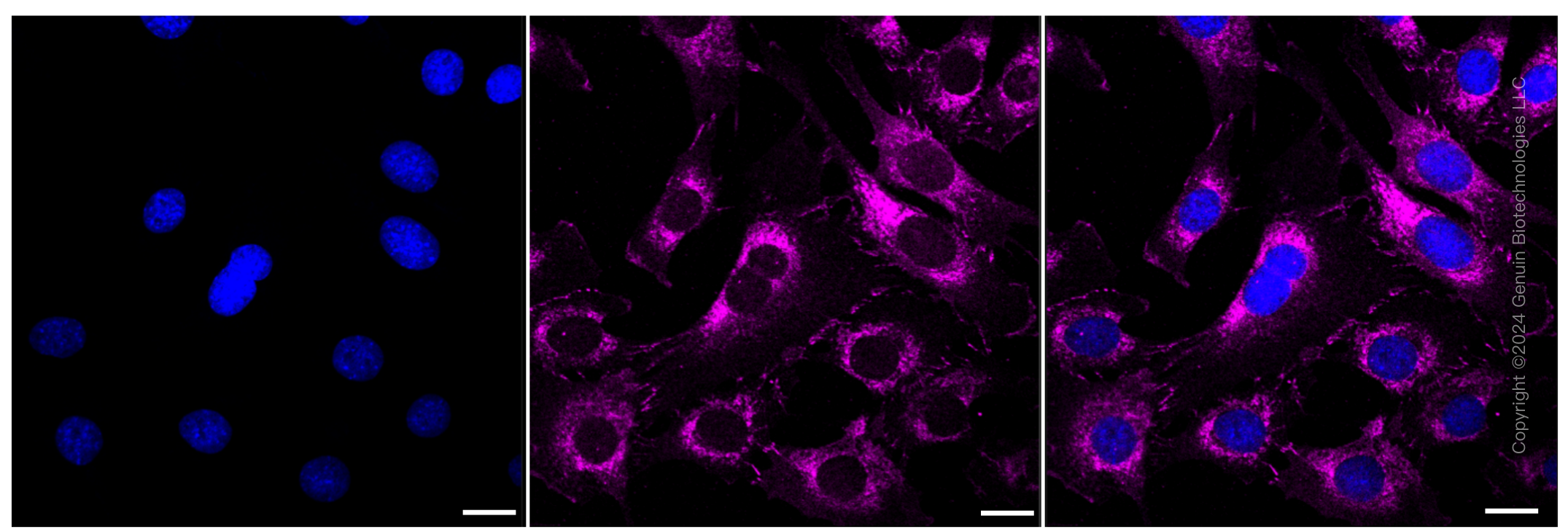 KD-Validated Anti-Catenin delta 1 Rabbit Monoclonal Antibody ABG1161