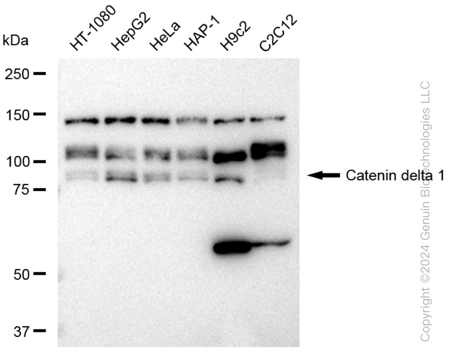 KD-Validated Anti-Catenin delta 1 Rabbit Monoclonal Antibody ABG1161