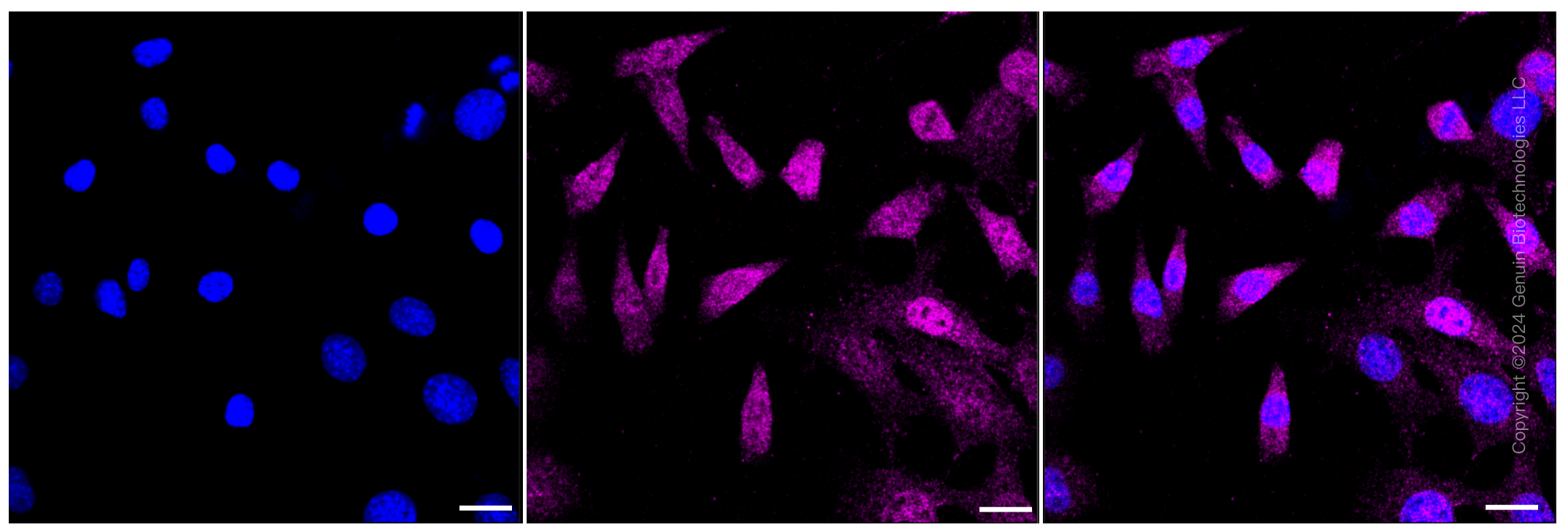 KD-Validated Anti-Androgen receptor Rabbit Monoclonal Antibody ABG1162