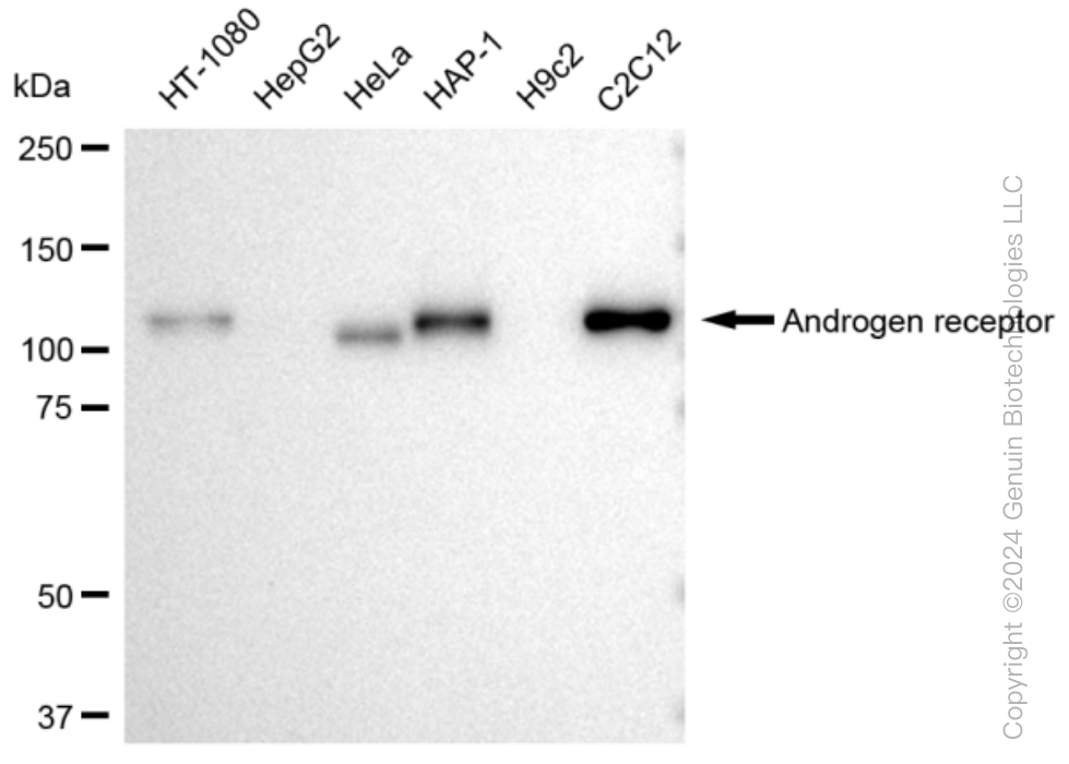 KD-Validated Anti-Androgen receptor Rabbit Monoclonal Antibody ABG1162