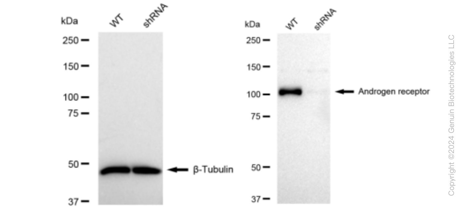 KD-Validated Anti-Androgen receptor Rabbit Monoclonal Antibody ABG1162