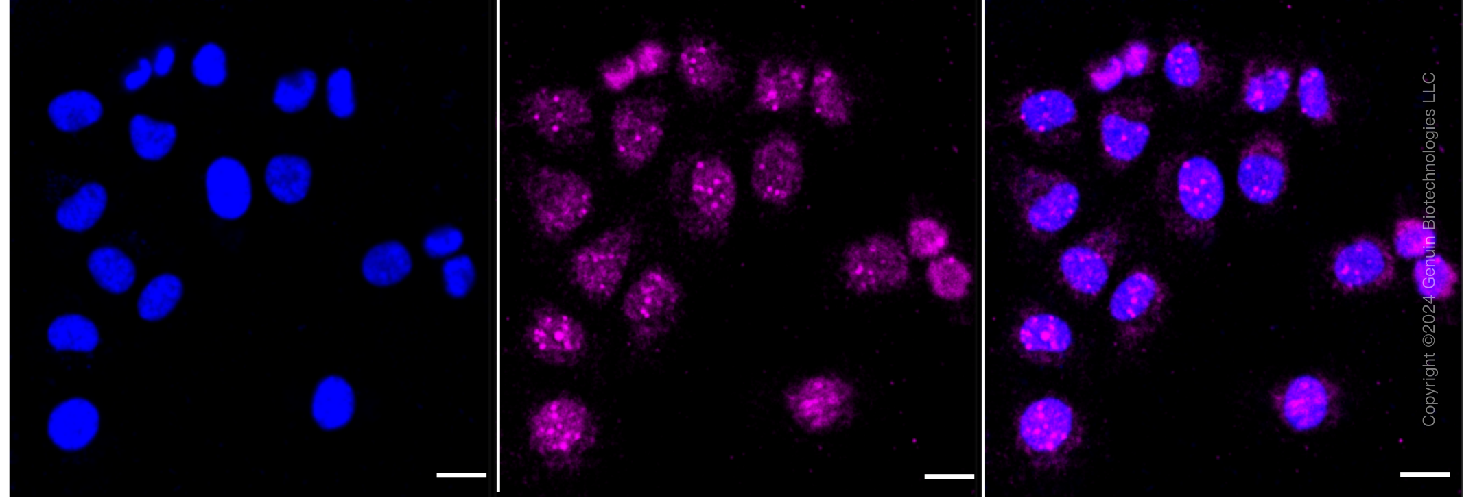 KD-Validated Anti-Bcl-XL Rabbit Monoclonal Antibody ABG1163