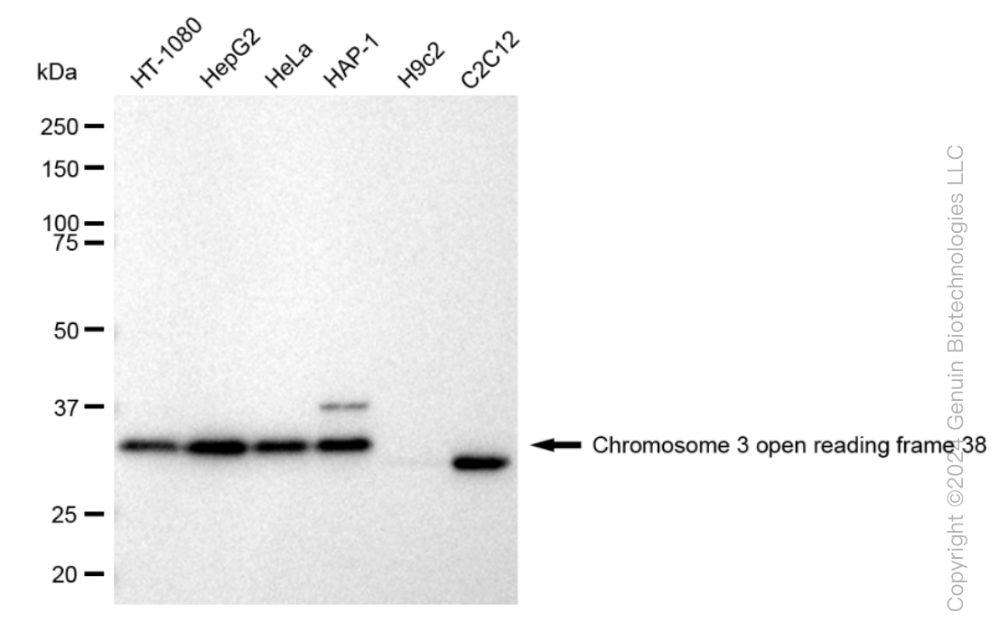 KD-Validated Anti-Chromosome 3 open reading frame 38 Rabbit Monoclonal Antibody ABG1167