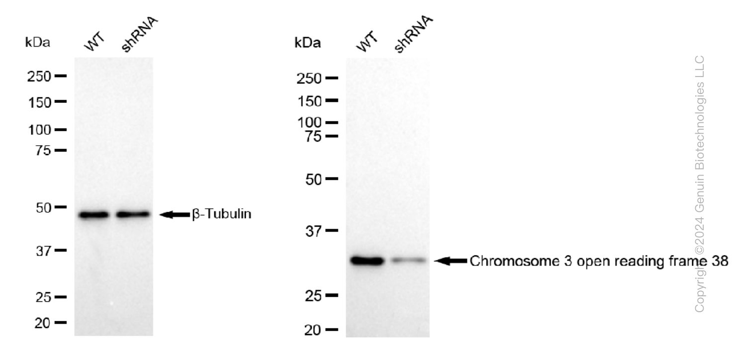 KD-Validated Anti-Chromosome 3 open reading frame 38 Rabbit Monoclonal Antibody ABG1167