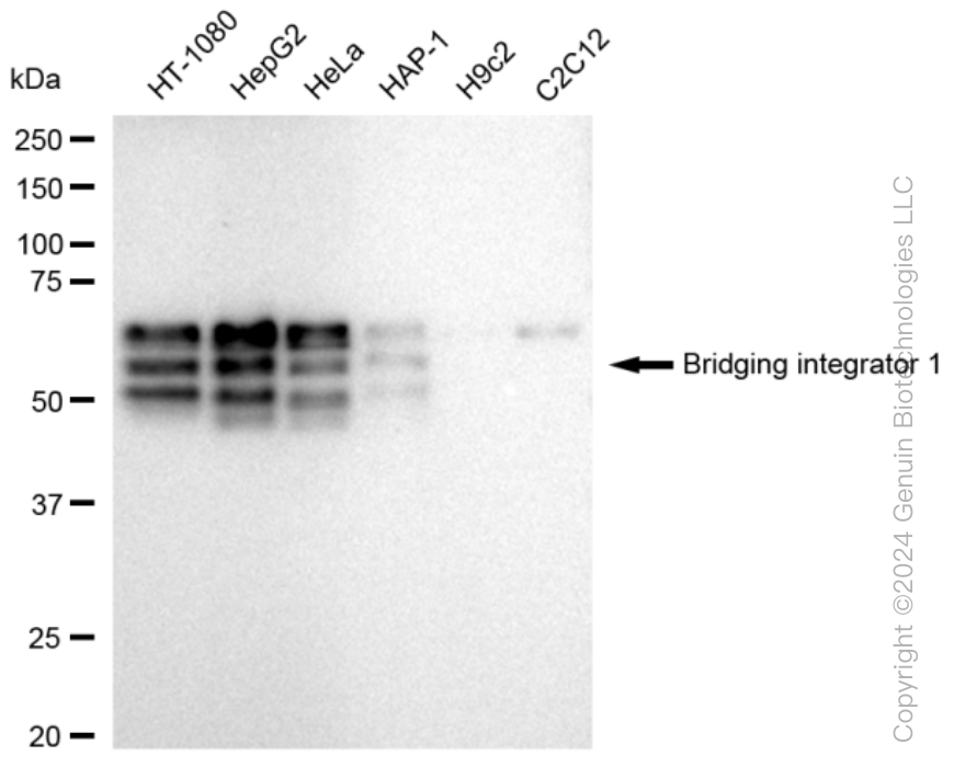 KD-Validated Anti-Bridging integrator 1 Rabbit Monoclonal Antibody ABG1168