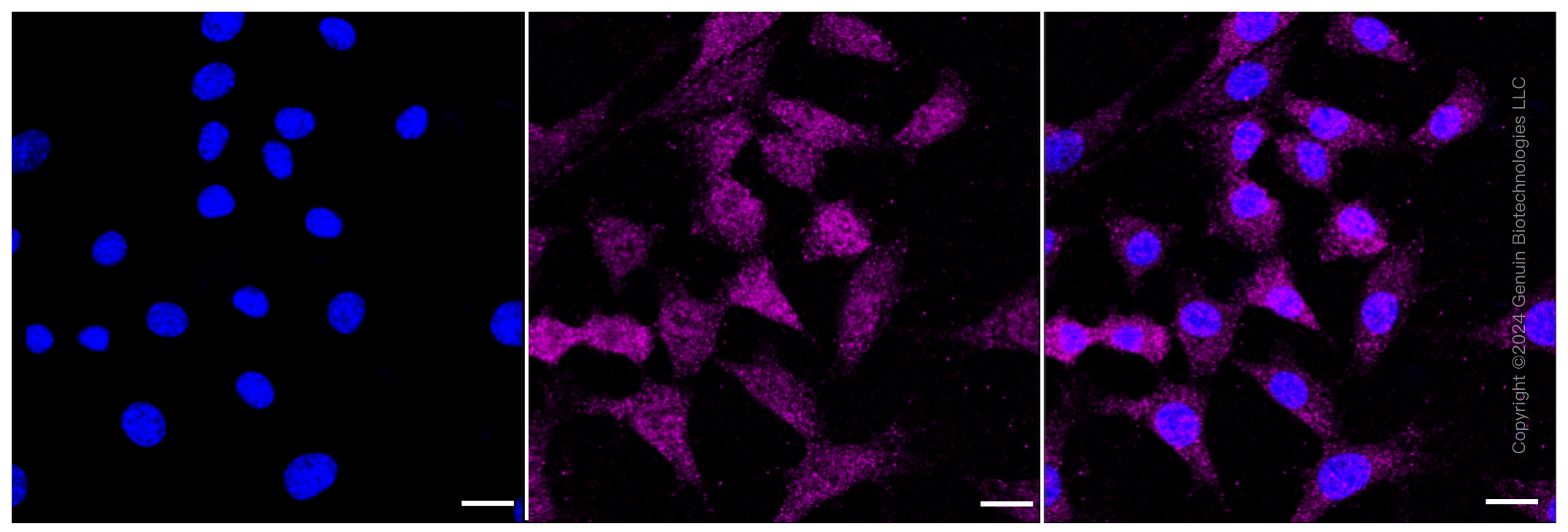 KD-Validated Anti-Androgen receptor Rabbit Monoclonal Antibody ABG1169