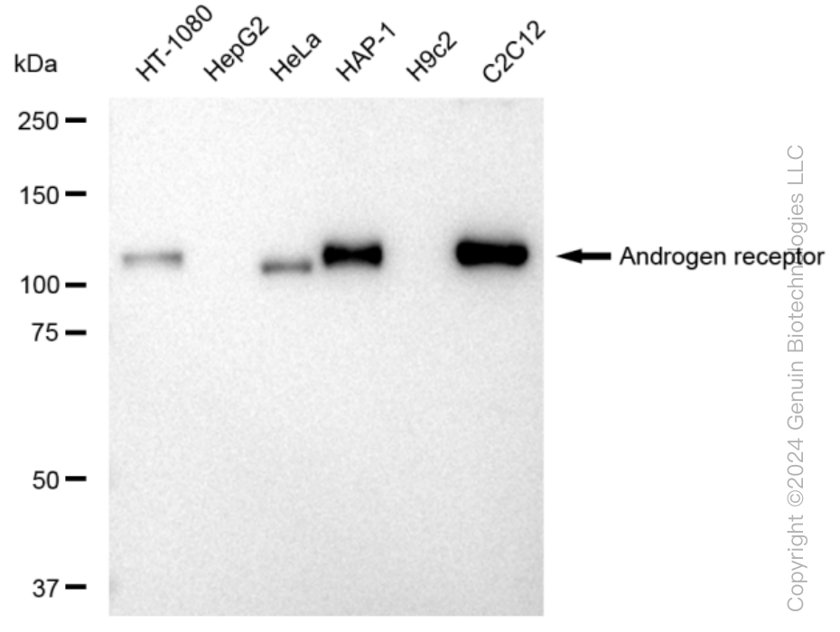 KD-Validated Anti-Androgen receptor Rabbit Monoclonal Antibody ABG1169