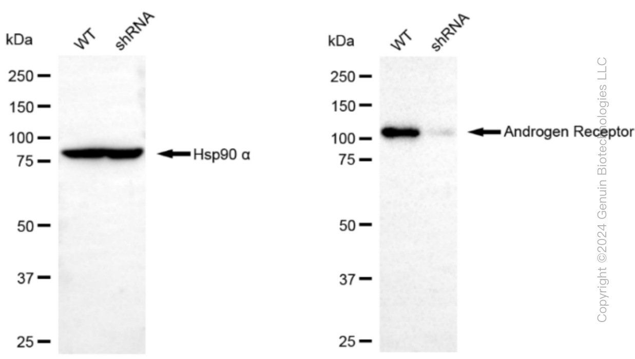 KD-Validated Anti-Androgen receptor Rabbit Monoclonal Antibody ABG1169
