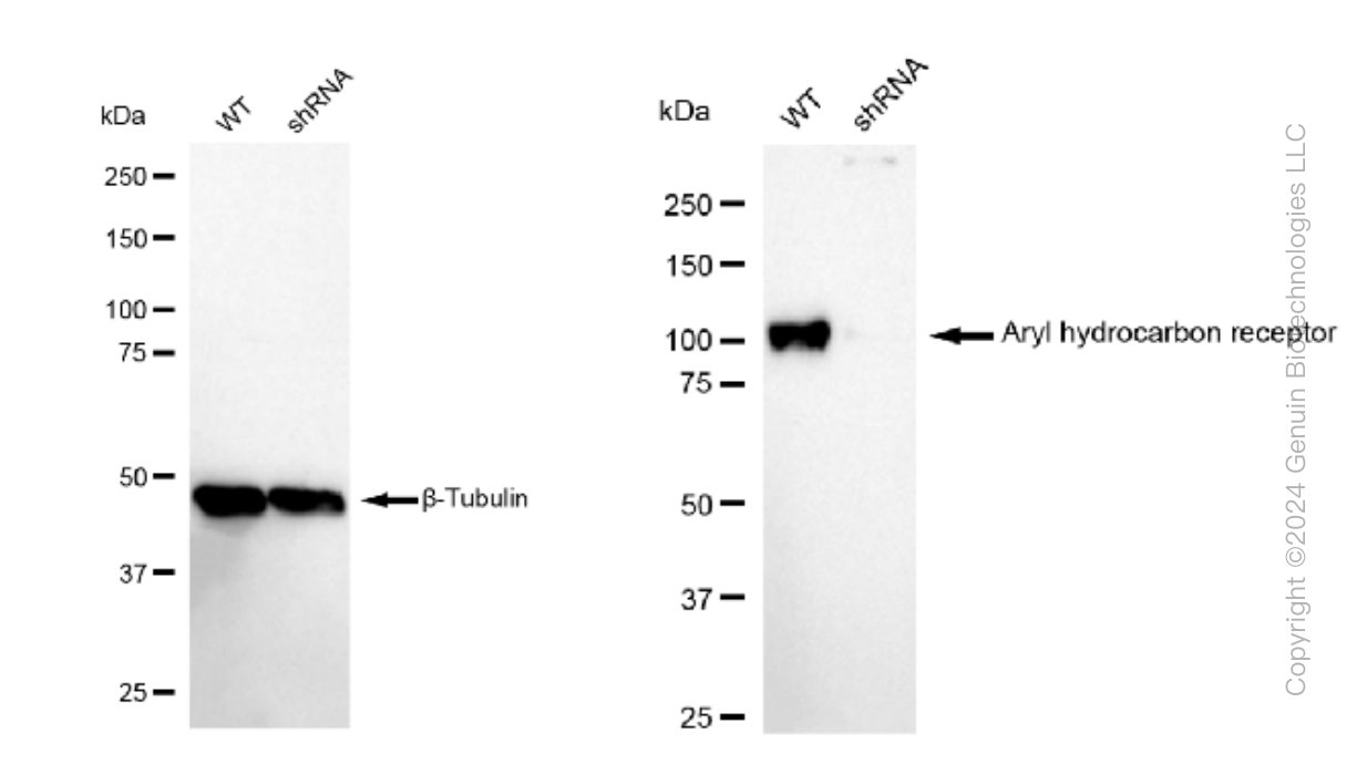 KD-Validated Anti-Aryl hydrocarbon receptor Rabbit Monoclonal Antibody ABG1170