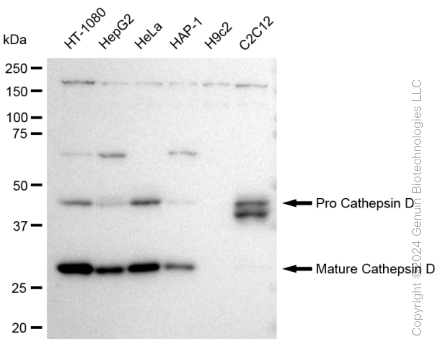 KD-Validated Anti-Cathepsin D Rabbit Monoclonal Antibody ABG1171