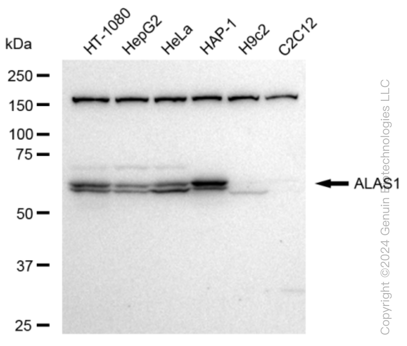 KD-Validated Anti-ALAS1 Rabbit Monoclonal Antibody ABG1174