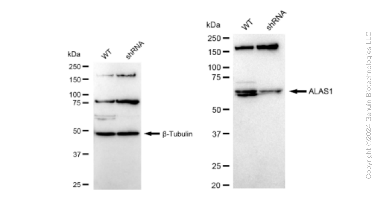 KD-Validated Anti-ALAS1 Rabbit Monoclonal Antibody ABG1174
