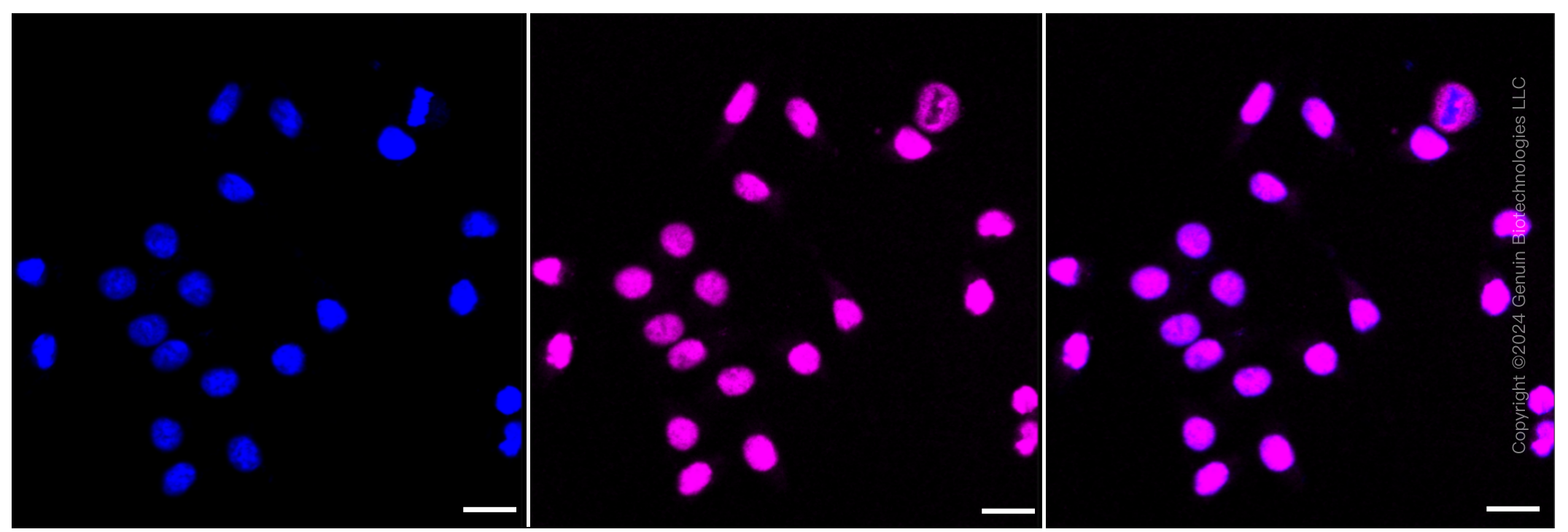 KD-Validated Anti-Checkpoint kinase 2 Rabbit Monoclonal Antibody ABG1175