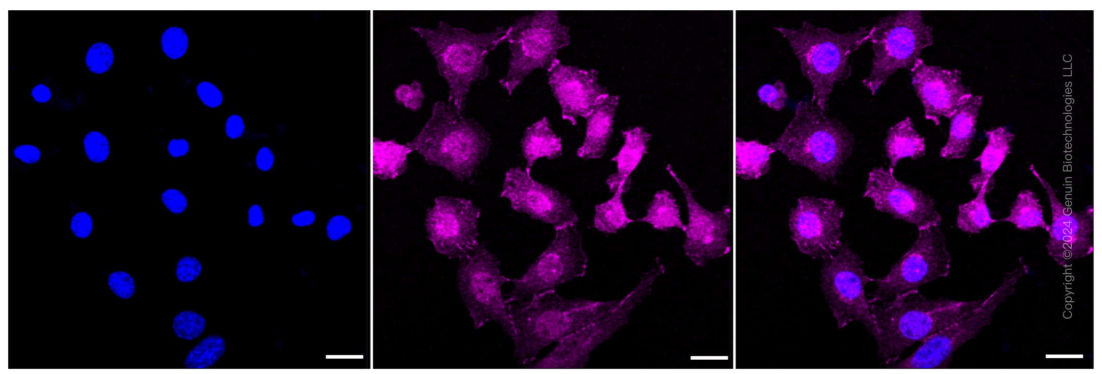 KD-Validated Anti-Catenin alpha 1 Rabbit Monoclonal Antibody ABG1177