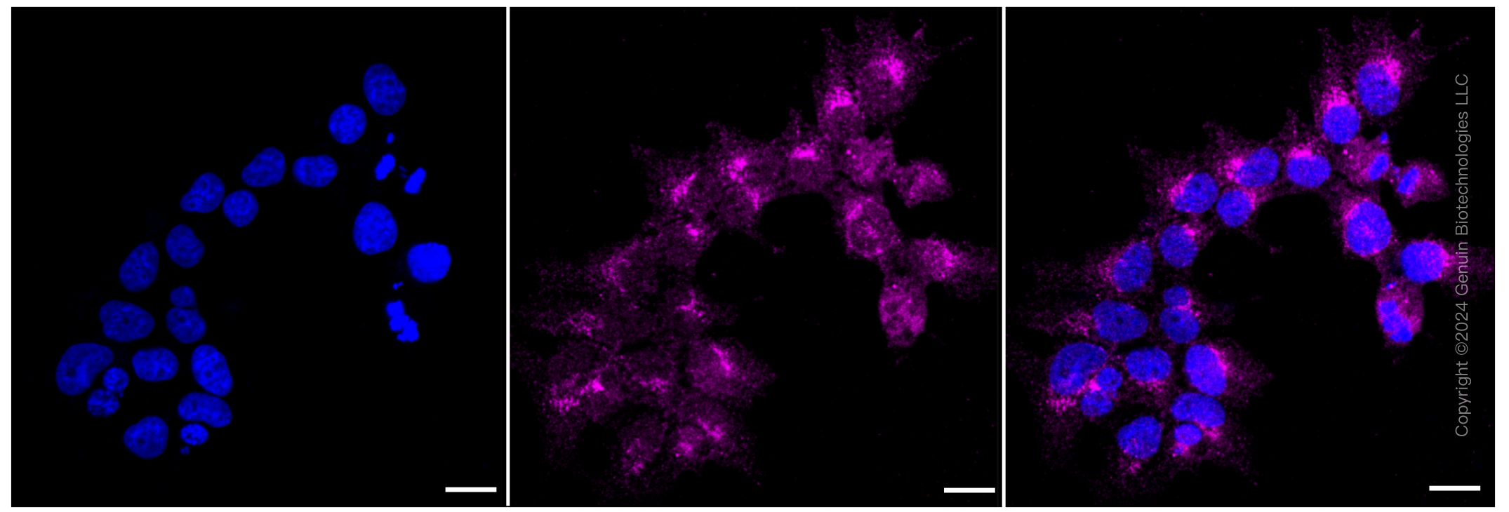 KD-Validated Anti-ATG9A Rabbit Monoclonal Antibody ABG1178
