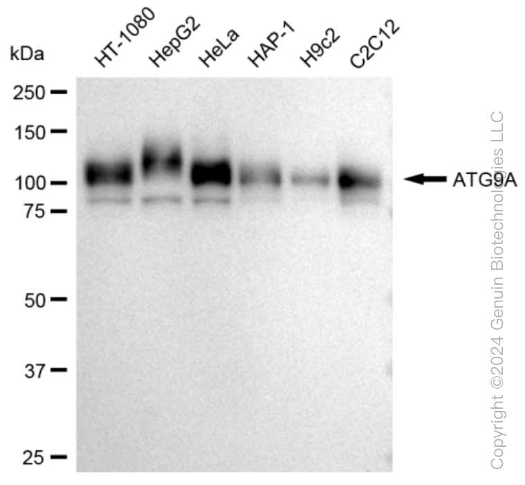 KD-Validated Anti-ATG9A Rabbit Monoclonal Antibody ABG1178