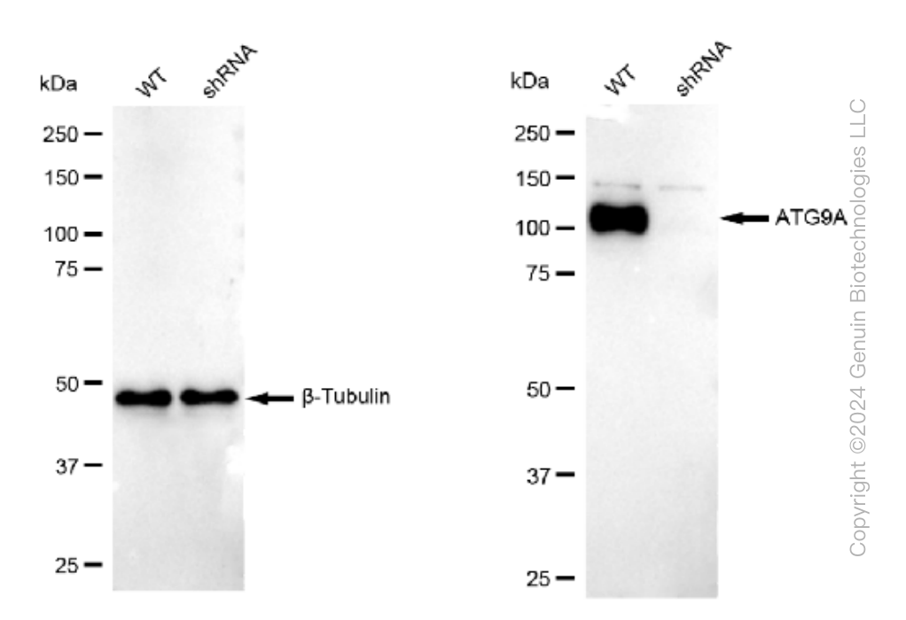 KD-Validated Anti-ATG9A Rabbit Monoclonal Antibody ABG1178