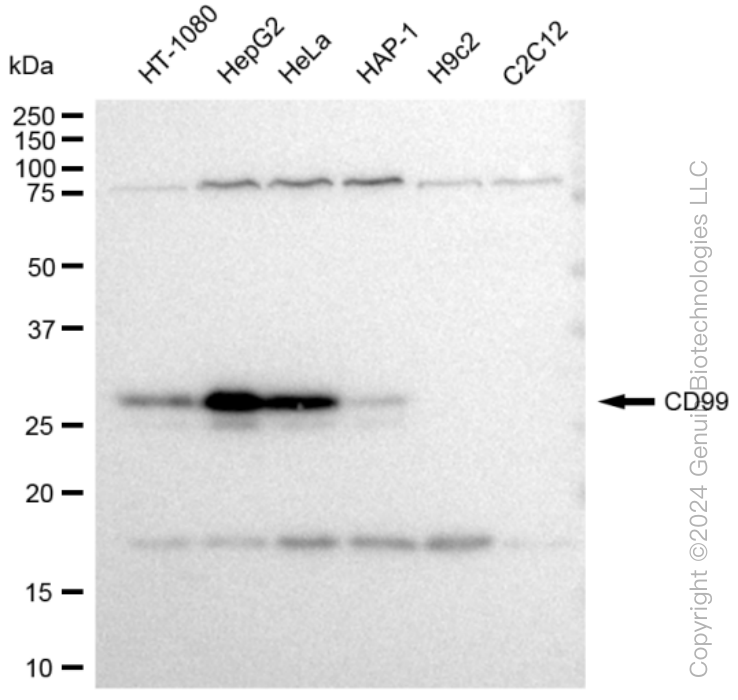 KD-Validated Anti-CD99 Rabbit Monoclonal Antibody ABG1188