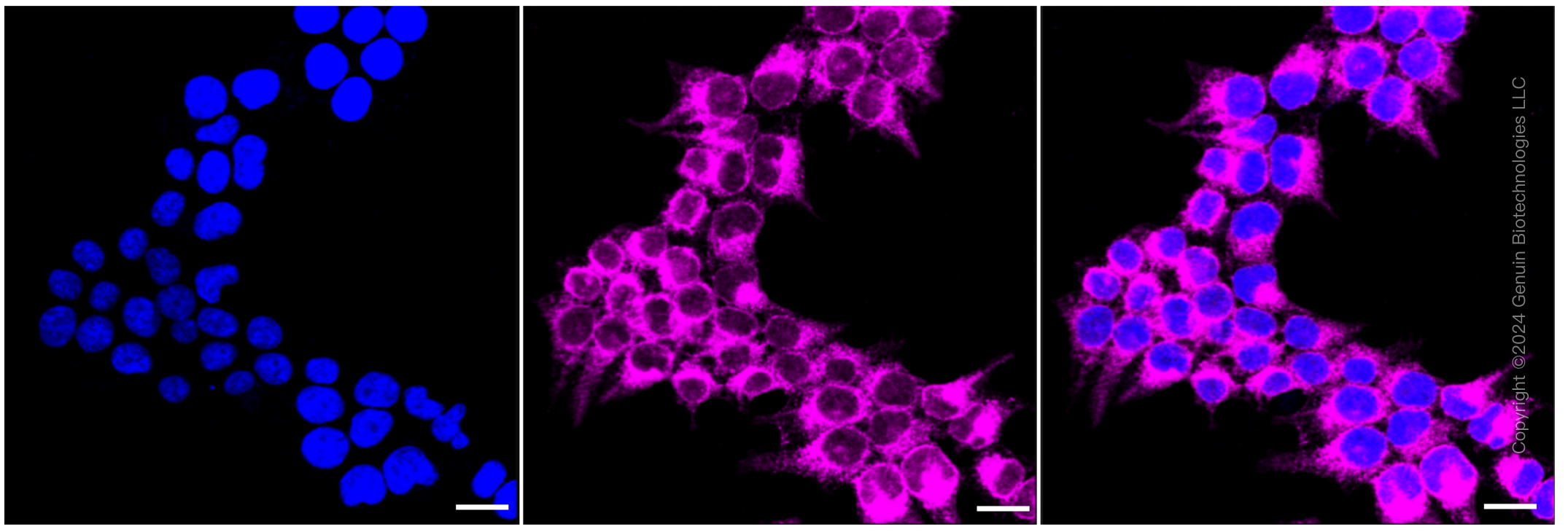 KD-Validated Anti-ATP2A2 Rabbit Monoclonal Antibody ABG1191
