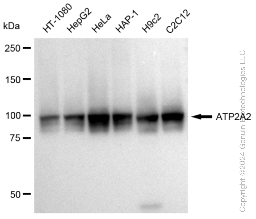 KD-Validated Anti-ATP2A2 Rabbit Monoclonal Antibody ABG1191