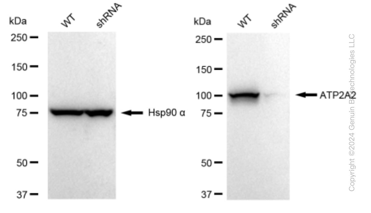 KD-Validated Anti-ATP2A2 Rabbit Monoclonal Antibody ABG1191
