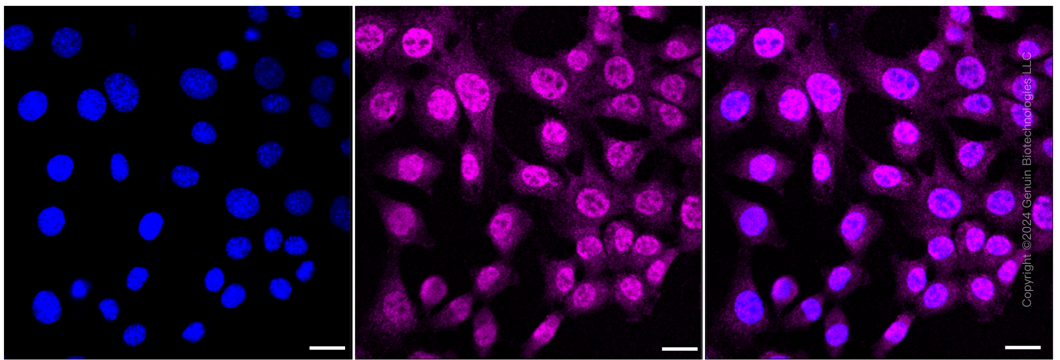 KD-Validated Anti-CTCF Rabbit Monoclonal Antibody ABG1192